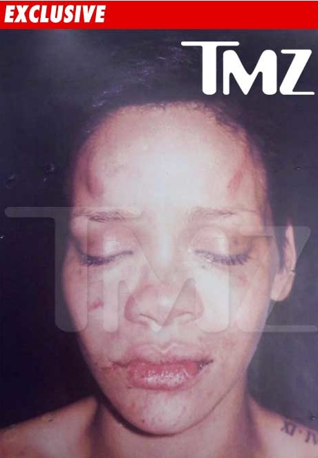 rihanna pictures after beating. Bloodied after beating by